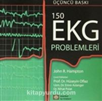 150 EKG Problemleri