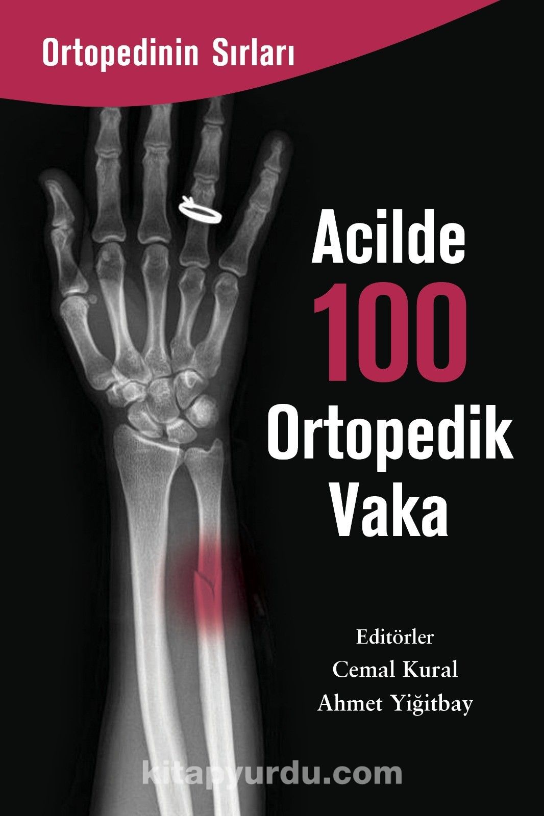 Acilde 100 Ortopedik Vaka